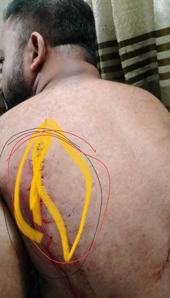 ব্রাহ্মণবাড়িয়া বিজয়নগরে শহীদ মিনারে ফুল দেওয়াকে কেন্দ্র করে বিএনপির দুই গ্রুপে সংঘর্ষে আহত ২