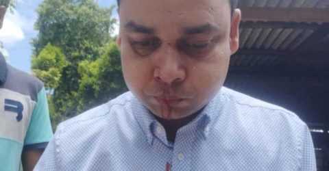 রাজারহাটে স্বাস্থ্য কমপ্লেক্সে কর্তব্যরত ফার্মাসিস্টের উপর দুবৃত্তের হামলা