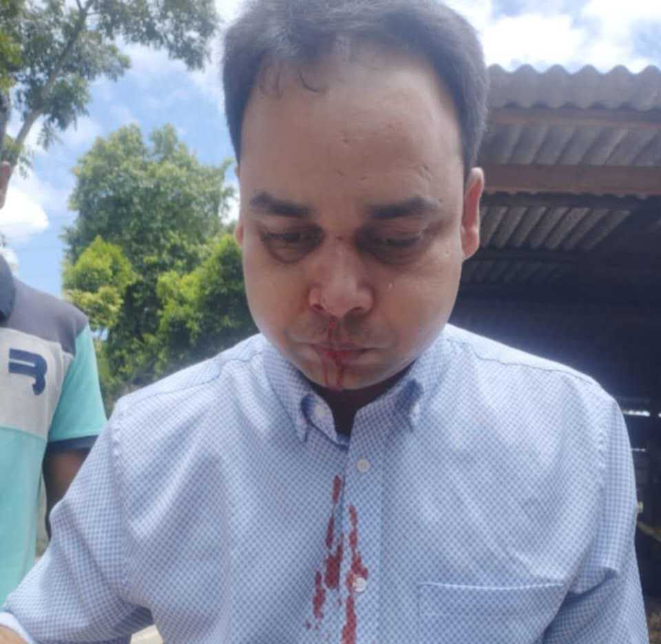 রাজারহাটে স্বাস্থ্য কমপ্লেক্সে কর্তব্যরত ফার্মাসিস্টের উপর দুবৃত্তের হামলা